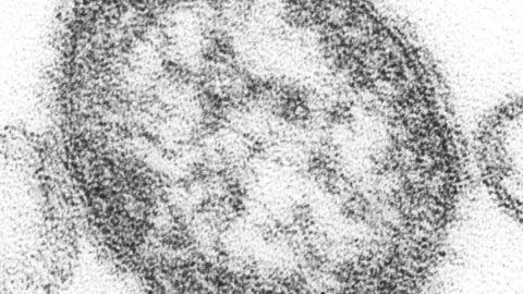 Electron microscope image of the measles virus