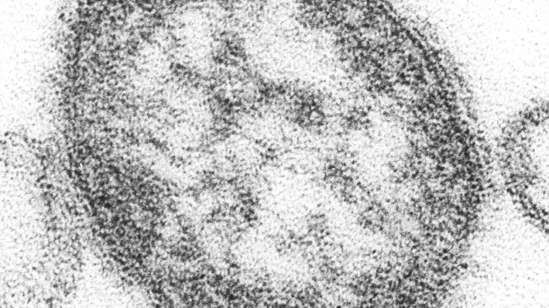 Electron microscope image of the measles virus