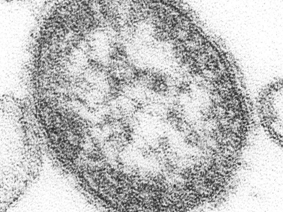 Electron microscope image of the measles virus